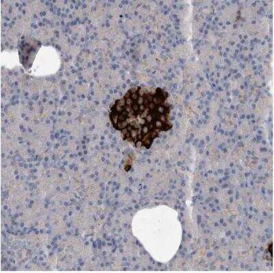 Immunohistochemistry-Paraffin: ALS2CR2 Antibody [NBP1-90183]