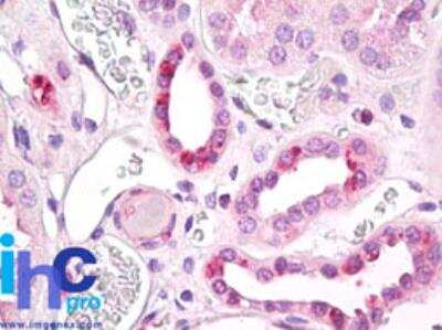 Immunohistochemistry-Paraffin: ALS2CR2 Antibody [NBP2-24680]