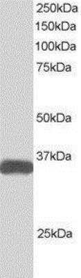 Western Blot: ALS2CR2 Antibody [NB100-1181]