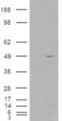 Western Blot: ALS2CR2 Antibody [NB100-1181]