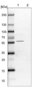 Western Blot: ALS2CR2 Antibody [NBP1-90183]