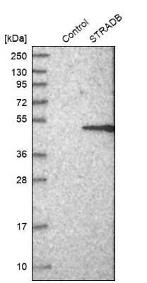 Western Blot: ALS2CR2 Antibody [NBP1-90184]