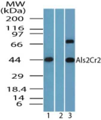 Western Blot: ALS2CR2 Antibody [NBP2-24680]