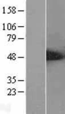 Western Blot: ALS2CR2 Overexpression Lysate [NBL1-07490]