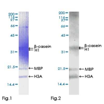 SDS-PAGE: Recombinant Human ALS2CR2 GST (N-Term) Protein [H00055437-P01]