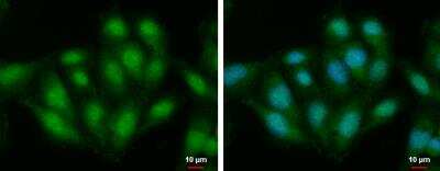 Immunocytochemistry/ Immunofluorescence: ALS2CR3 Antibody [NBP2-15369]