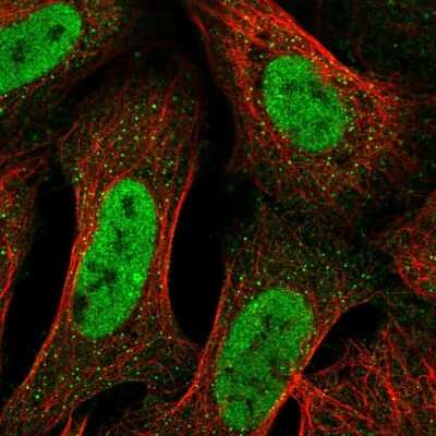 Immunocytochemistry/ Immunofluorescence: ALS2CR3 Antibody [NBP2-55830]