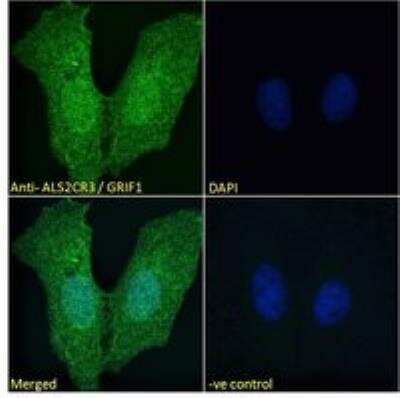 Immunocytochemistry/ Immunofluorescence: ALS2CR3 Antibody [NBP2-80144]