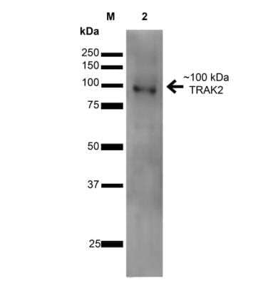 Western Blot: ALS2CR3 Antibody (S390-43) [NBP2-59333]