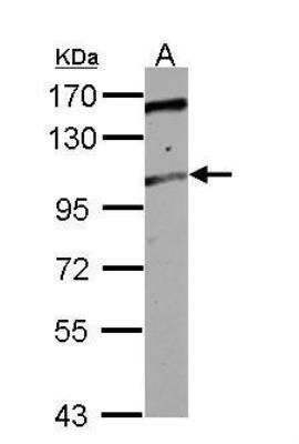 Western Blot: ALS2CR3 Antibody [NBP2-15369]