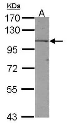 Western Blot: ALS2CR3 Antibody [NBP2-15370]