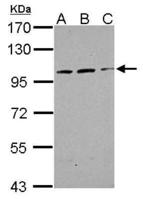 Western Blot: ALS2CR3 Antibody [NBP2-15370]