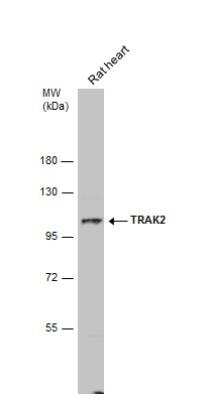 Western Blot: ALS2CR3 Antibody [NBP2-15370]