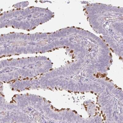 Immunohistochemistry-Paraffin: ALS2CR4 Antibody [NBP2-33656]