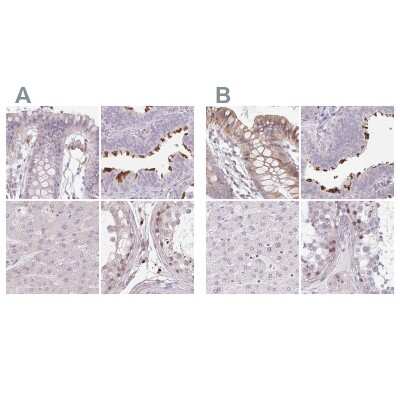 Immunohistochemistry-Paraffin: ALS2CR4 Antibody [NBP2-33656]