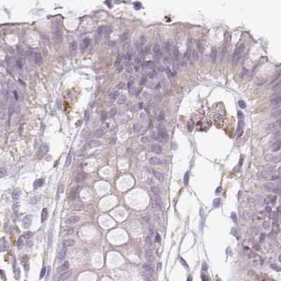 Immunohistochemistry-Paraffin: ALS2CR4 Antibody [NBP2-33656]