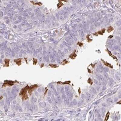 Immunohistochemistry-Paraffin: ALS2CR4 Antibody [NBP2-33656]
