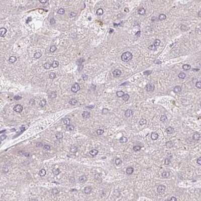 Immunohistochemistry-Paraffin: ALS2CR4 Antibody [NBP2-33656]
