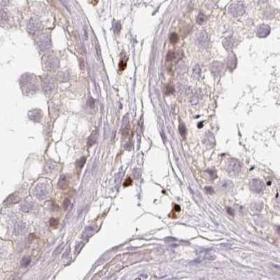 Immunohistochemistry-Paraffin: ALS2CR4 Antibody [NBP2-33656]