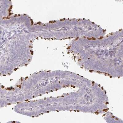 Immunohistochemistry-Paraffin: ALS2CR4 Antibody [NBP2-33731]