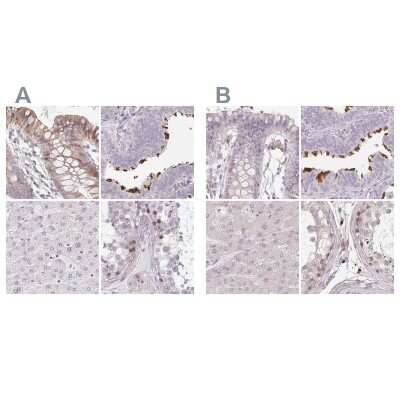 Immunohistochemistry-Paraffin: ALS2CR4 Antibody [NBP2-33731]