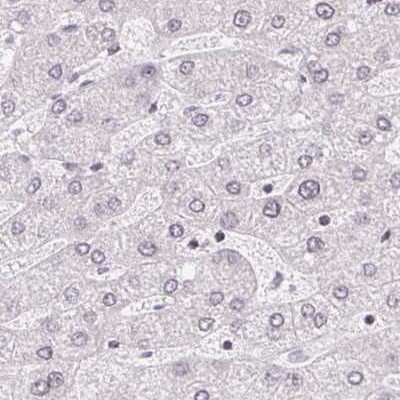 Immunohistochemistry-Paraffin: ALS2CR4 Antibody [NBP2-33731]