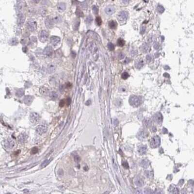 Immunohistochemistry-Paraffin: ALS2CR4 Antibody [NBP2-33731]