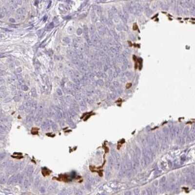 Immunohistochemistry-Paraffin: ALS2CR4 Antibody [NBP2-33731]