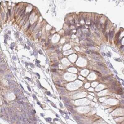 Immunohistochemistry-Paraffin: ALS2CR4 Antibody [NBP2-33731]