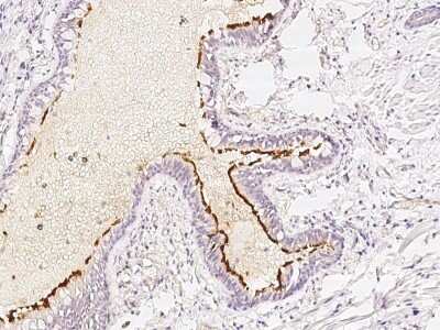 Immunohistochemistry-Paraffin: ALS2CR4 Antibody [NBP2-97790]