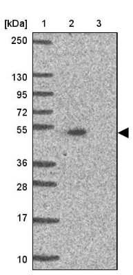 Western Blot: ALS2CR4 Antibody [NBP2-33656]