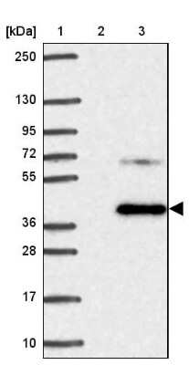 Western Blot: ALS2CR4 Antibody [NBP2-33731]