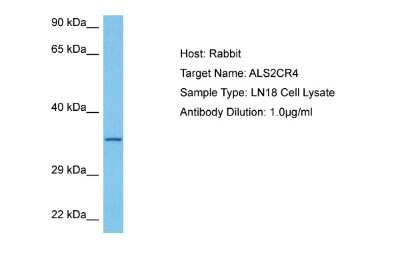 Western Blot: ALS2CR4 Antibody [NBP2-84424]