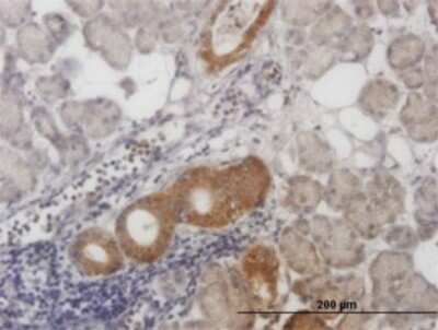 Immunohistochemistry-Paraffin: ALS2CR8 Antibody (2A3) [H00079800-M01]