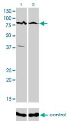 Western Blot: ALS2CR8 Antibody (2A3) [H00079800-M01]