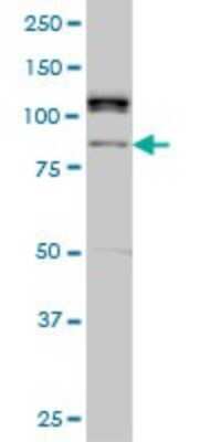 Western Blot: ALS2CR8 Antibody (2A3) [H00079800-M01]