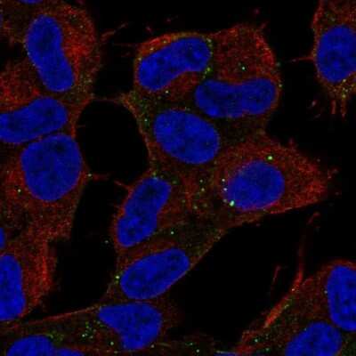 Immunocytochemistry/ Immunofluorescence: ALS2CR8 Antibody [NBP2-68649]