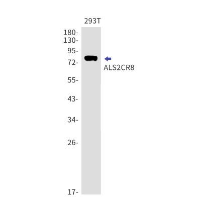 Western Blot: ALS2CR8 Antibody (S04-5G7) [NBP3-19568]