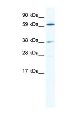 Western Blot: ALX3 Antibody [NBP1-80285]