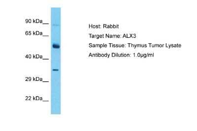 Western Blot: ALX3 Antibody [NBP2-83932]