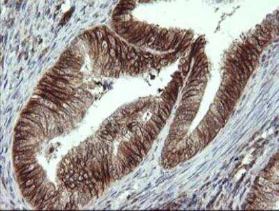 Immunohistochemistry-Paraffin: ALX4 Antibody (OTI6B3) [NBP2-45490]