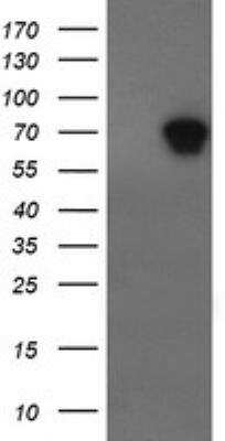 Western Blot: ALX4 Antibody (OTI6B3) [NBP2-45490]