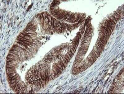 Immunohistochemistry: ALX4 Antibody (OTI6B3) - Azide and BSA Free [NBP2-72123]