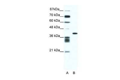 Western Blot: ALX4 Antibody [NBP2-86987]