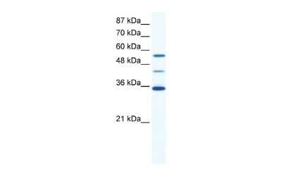 Western Blot: ALX4 Antibody [NBP2-86988]