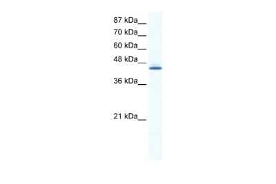 Western Blot: ALX4 Antibody [NBP2-86989]