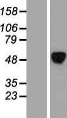 Western Blot: ALX4 Overexpression Lysate [NBP2-06508]