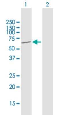 Western Blot: Ameloblastin Antibody [H00000258-B01P]