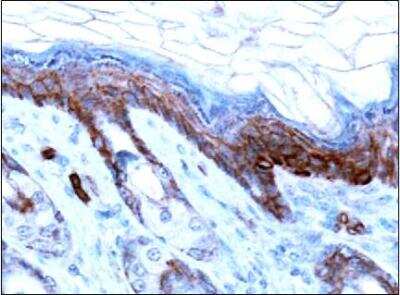 Immunohistochemistry: AMBRA1 Antibody - BSA Free [NBP1-07124]