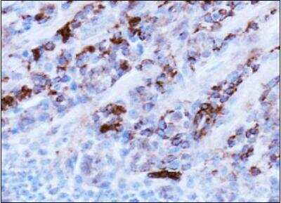 Immunohistochemistry: AMBRA1 Antibody - BSA Free [NBP1-07124]